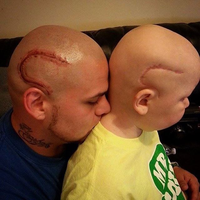 Tatuaje cicatriz padre